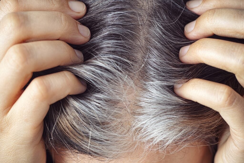 Human hair roots turning gray